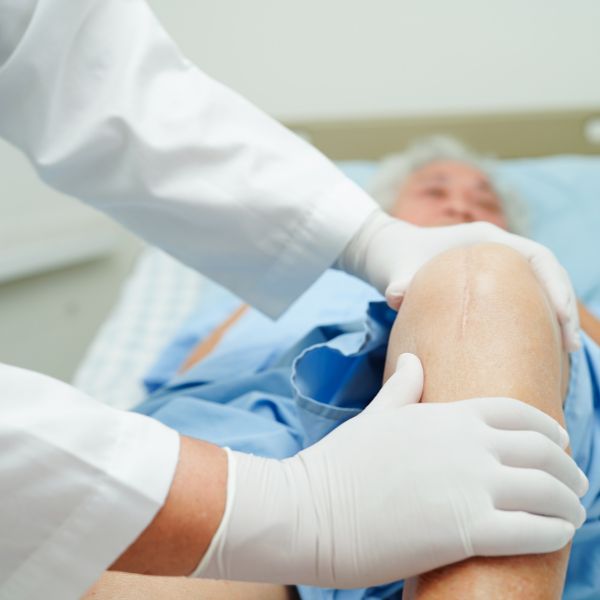 A doctor examining knee of a patient