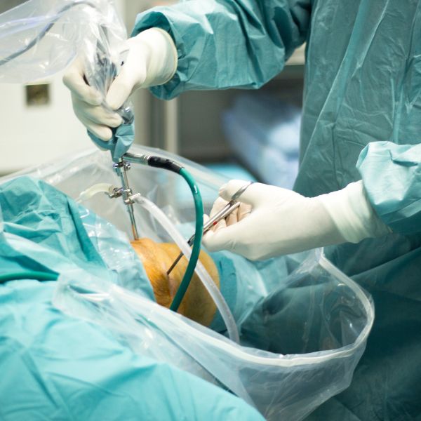 a doctor performing knee arthroscopy